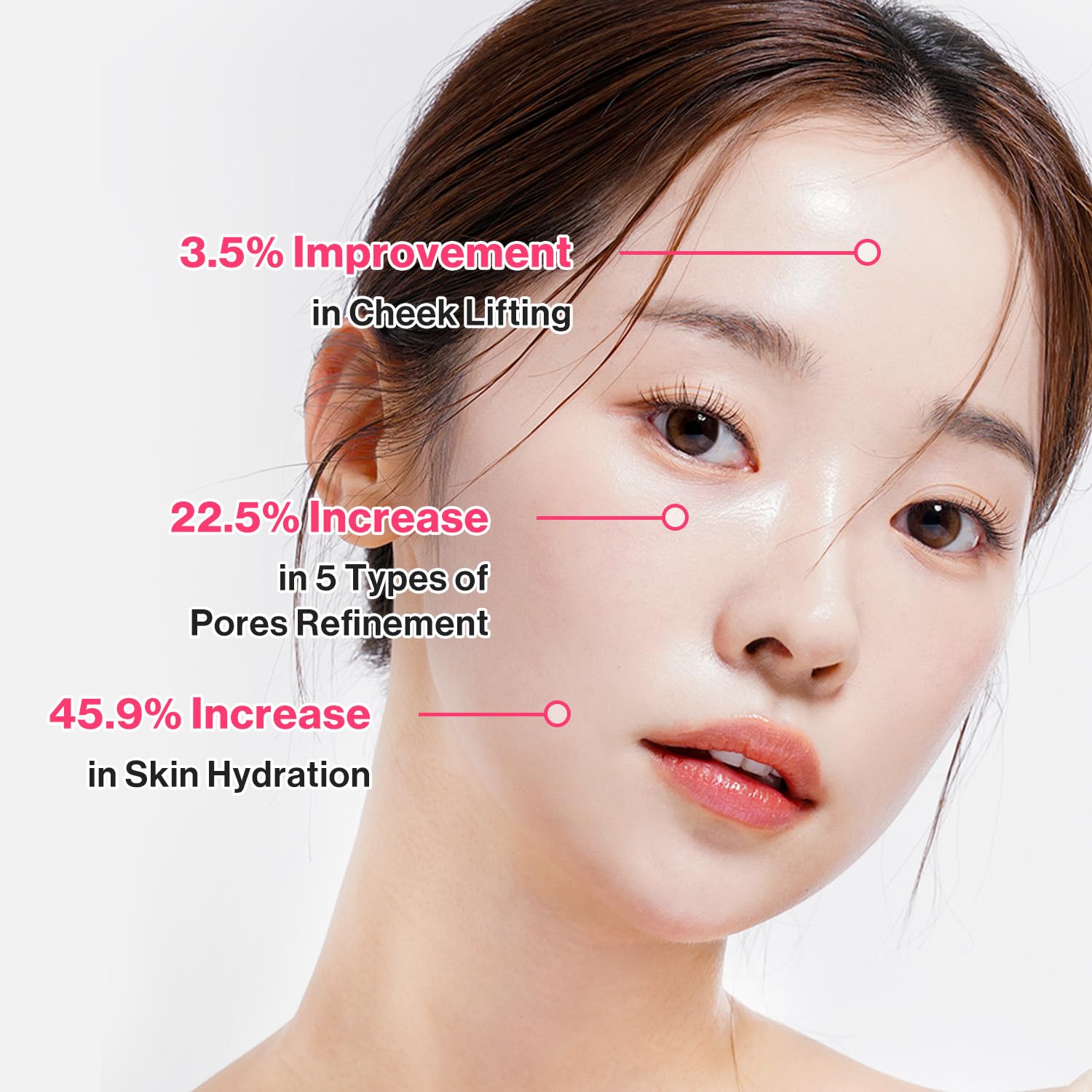 Exo-V Prolifting 1 Week Set - Filler Lux