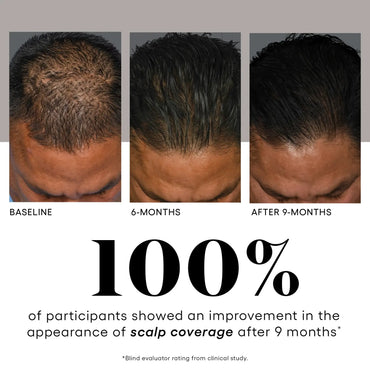 HAIR Serum - Filler Lux