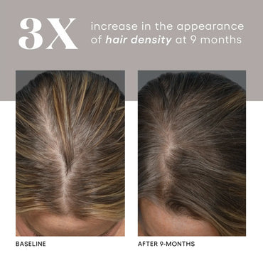 HAIR Serum - Filler Lux