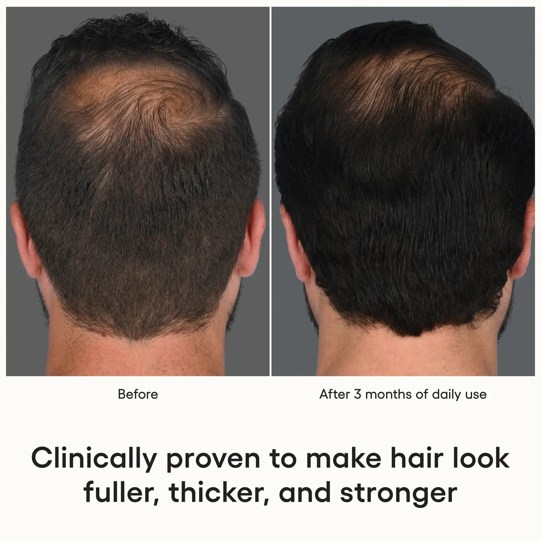 HAIR Serum - Filler Lux