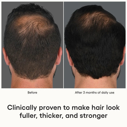 HAIR Serum - Filler Lux