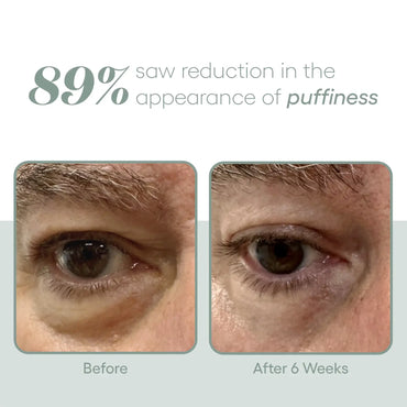EYE Serum - Filler Lux
