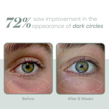 EYE Serum - Filler Lux