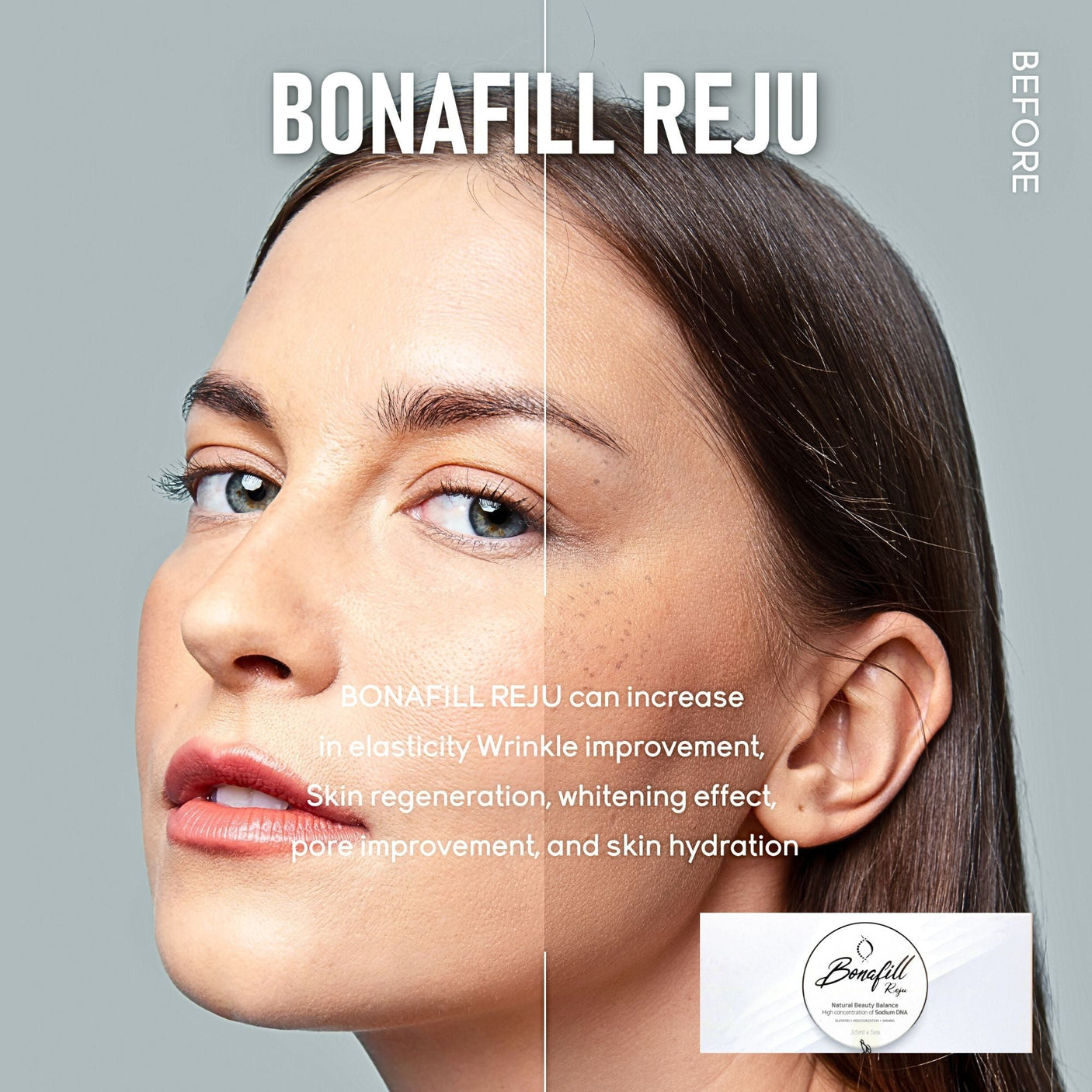 Bonafill Reju - Filler Lux™ - Mesotherapy - Let It beauty Co., Ltd.