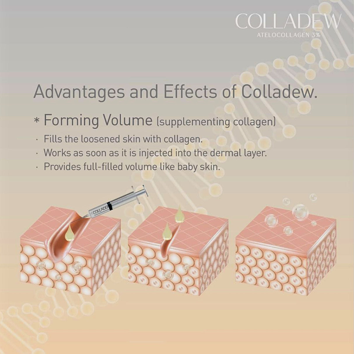 Colladew Atelocolagen 3% - Filler Lux™ - Mesotherapy - Quiver Medic