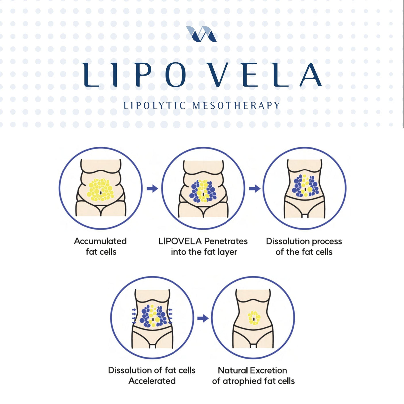 Lipo Vela Lipolytic - Filler Lux™ - Lipolytic - HJ Corporations