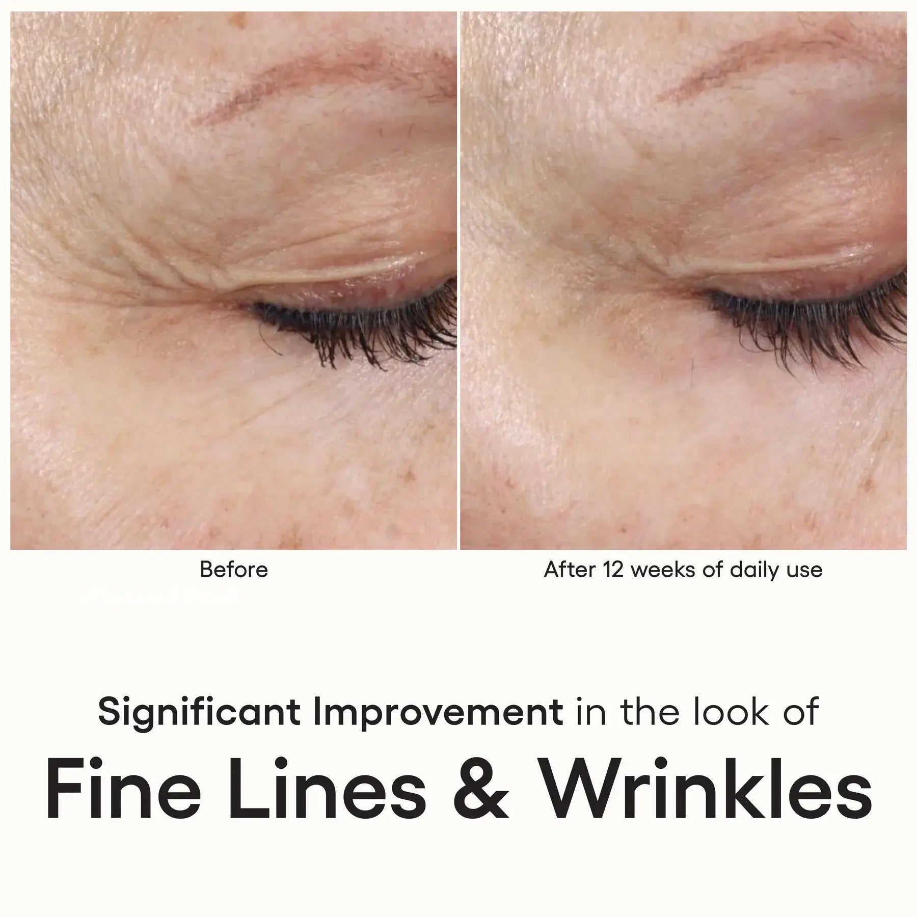 INTENSE Serum - Filler Lux