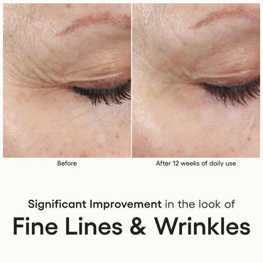 INTENSE Serum - Filler Lux