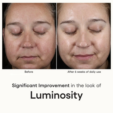 INTENSE Serum - Filler Lux